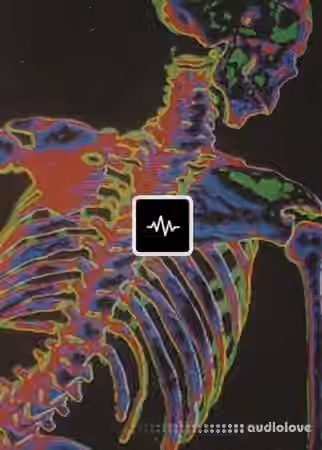 WavSupply Radioactive (Loop Kit) [WAV]